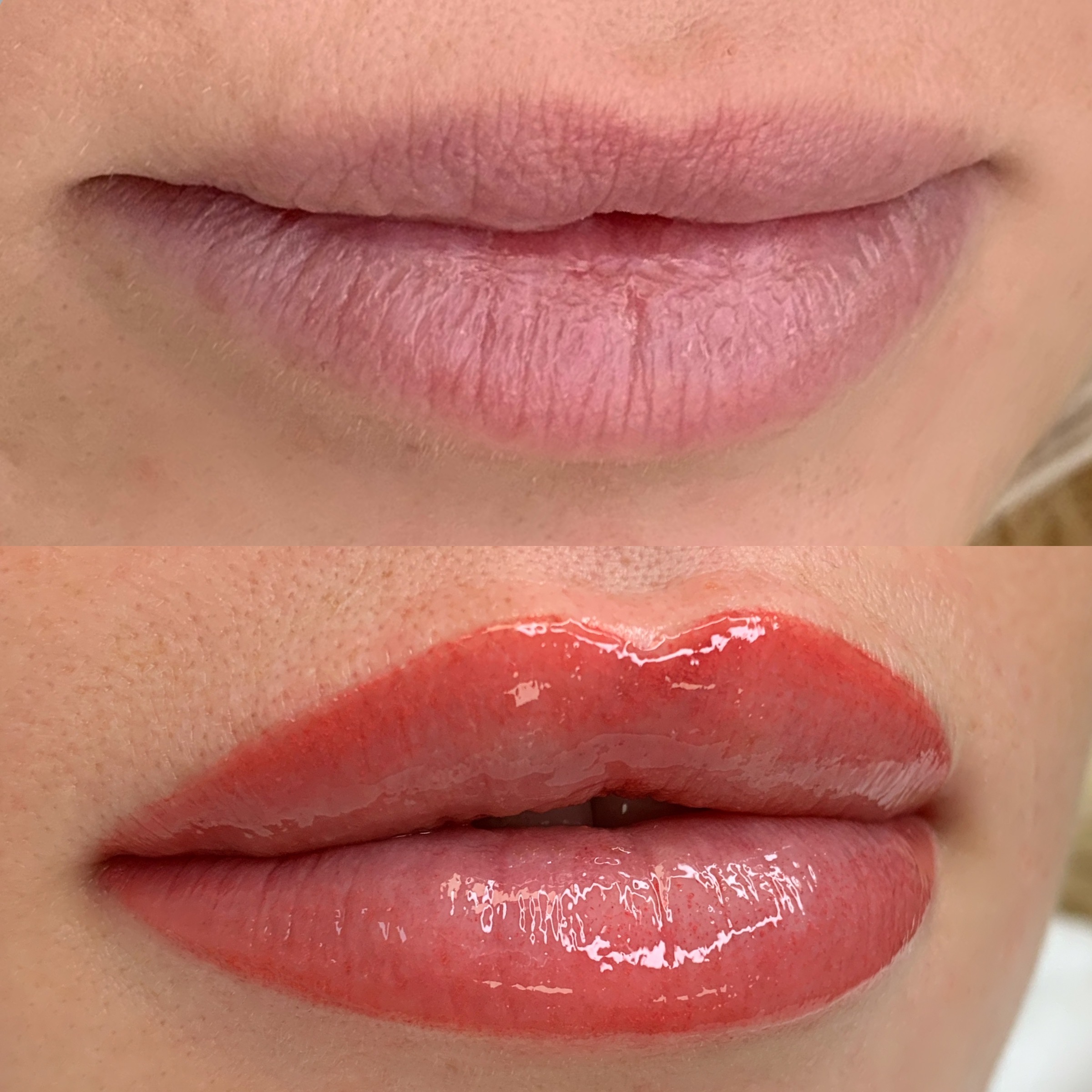 Lippenpigmentierung Vorher Nachher