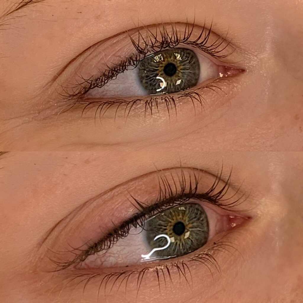 Wimpernkranzverdichtung Beauty Royal